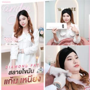 ฉีดไดมอนแฟต อุดรธานี