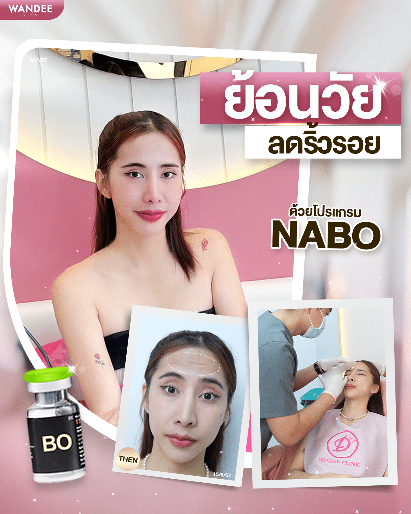 รีวิวโบท็อกซ์