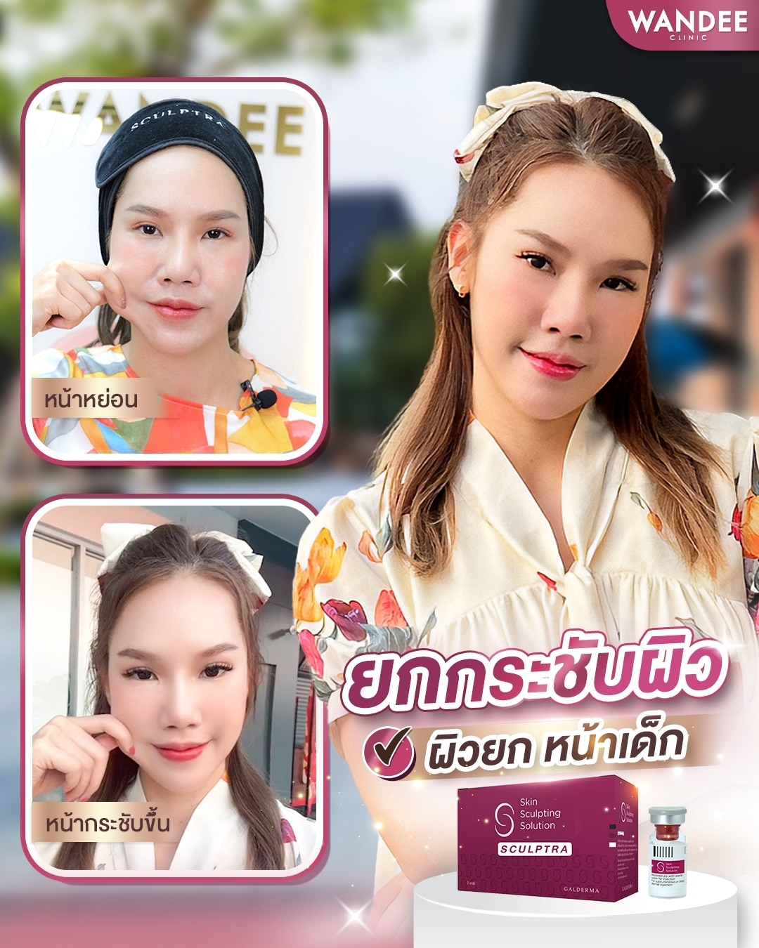 สเกาต้า