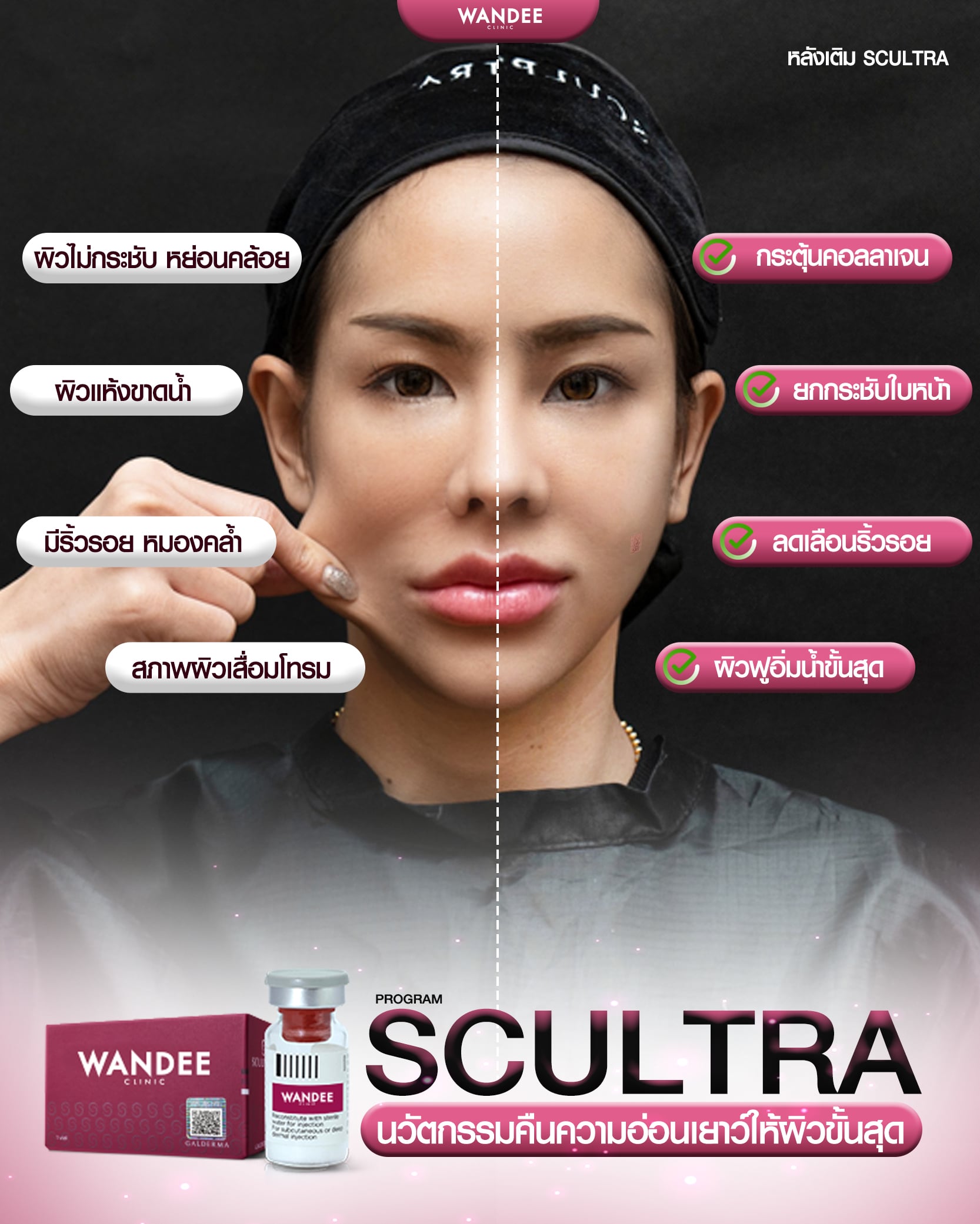 สเกาต้า