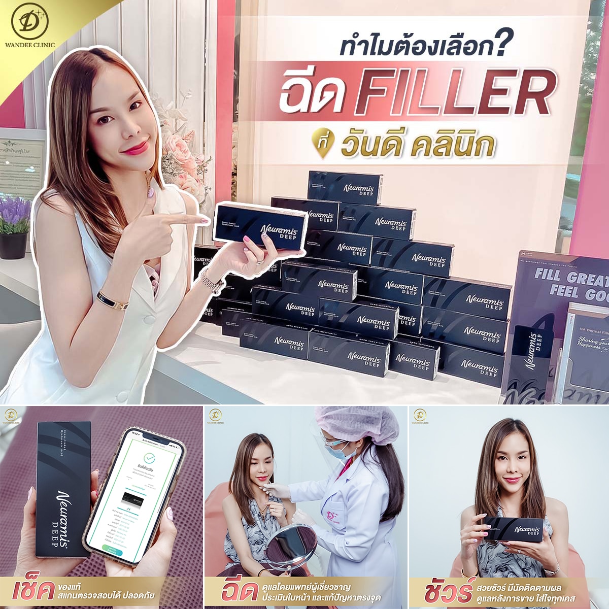 ฉีดฟิลเลอร์