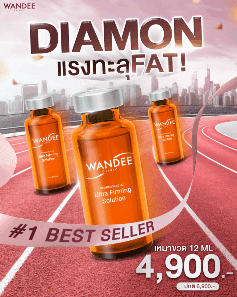 ไดมอนแฟต อุดร