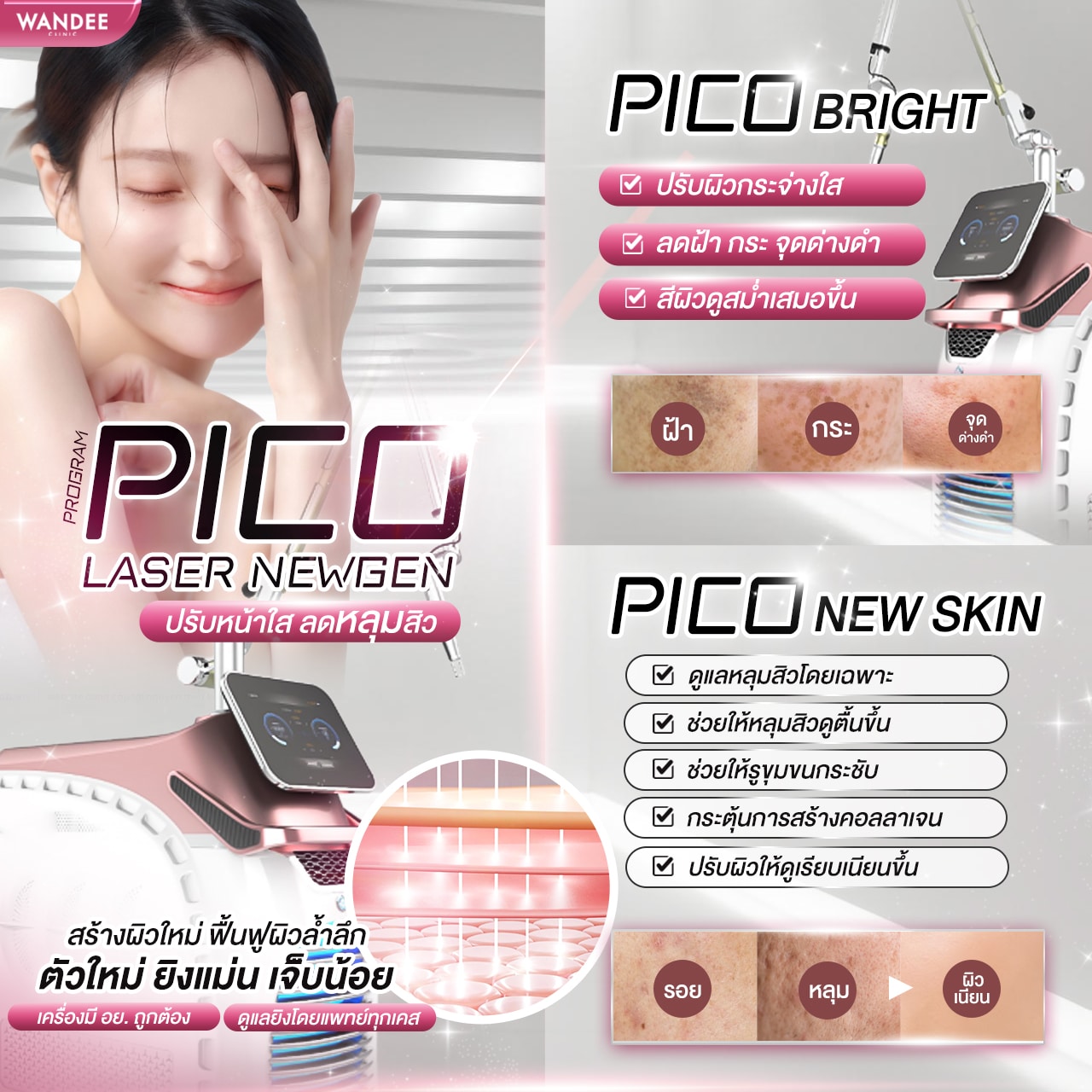 pico laser