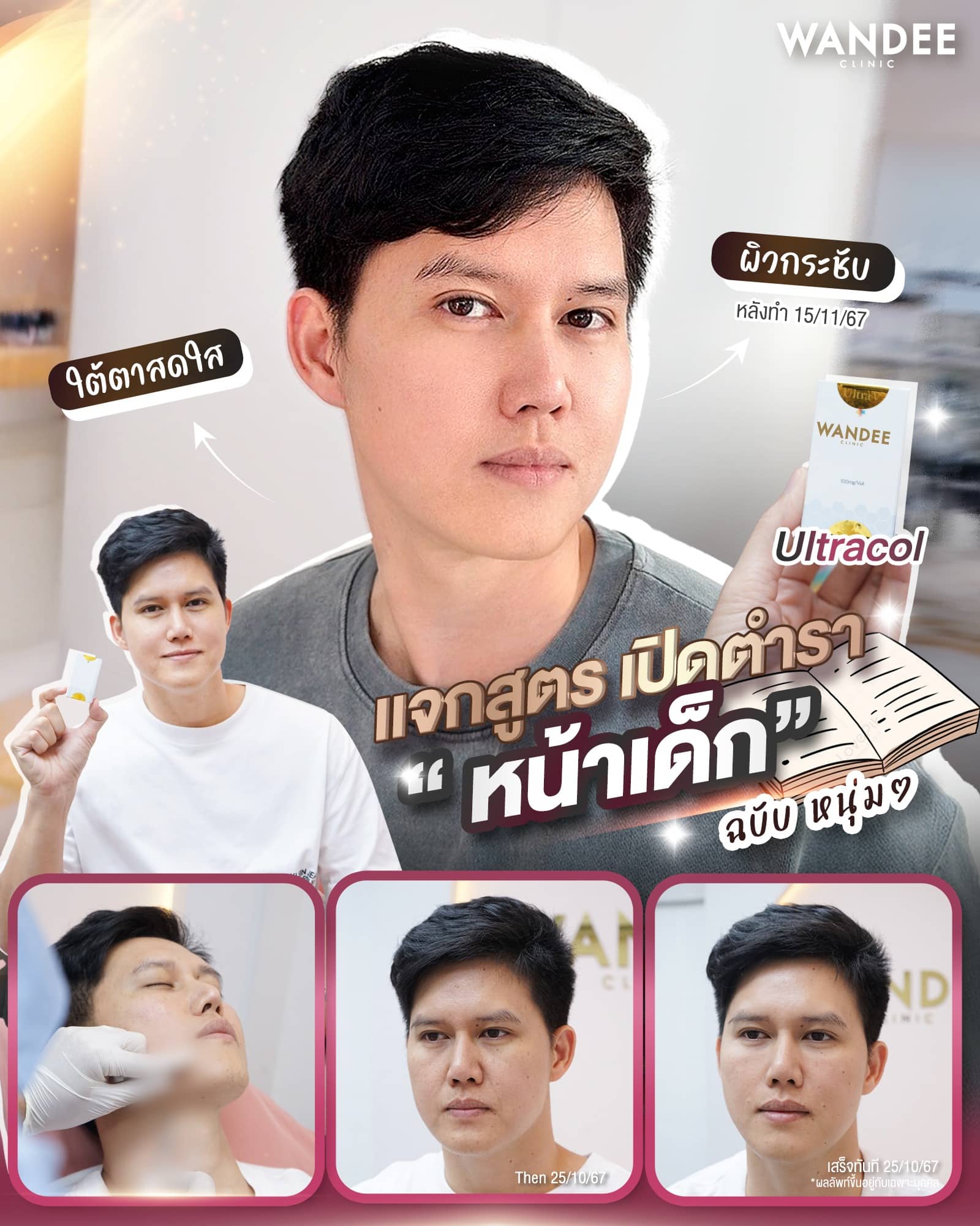 Ultracol อุดร