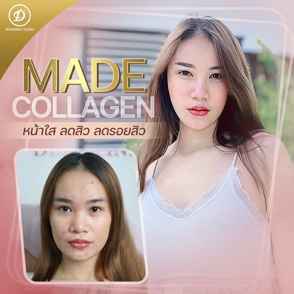 รีวิวMADE